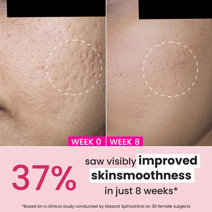 Retinol + Ceramide Night Cream for Fine Lines & Wrinkles